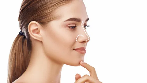 Rejuvenating Beauty The Art and Science of Mid-Face Lifts