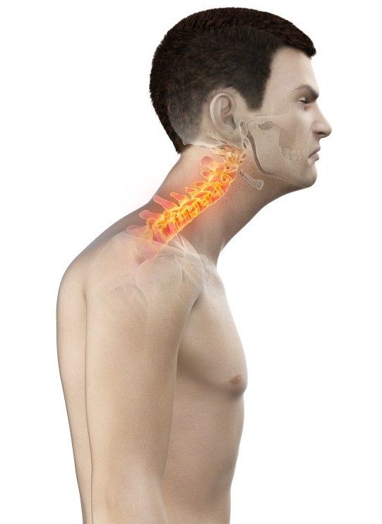 The Impact of Crane Neck Posture on Health: Causes, Consequences, and Solutions